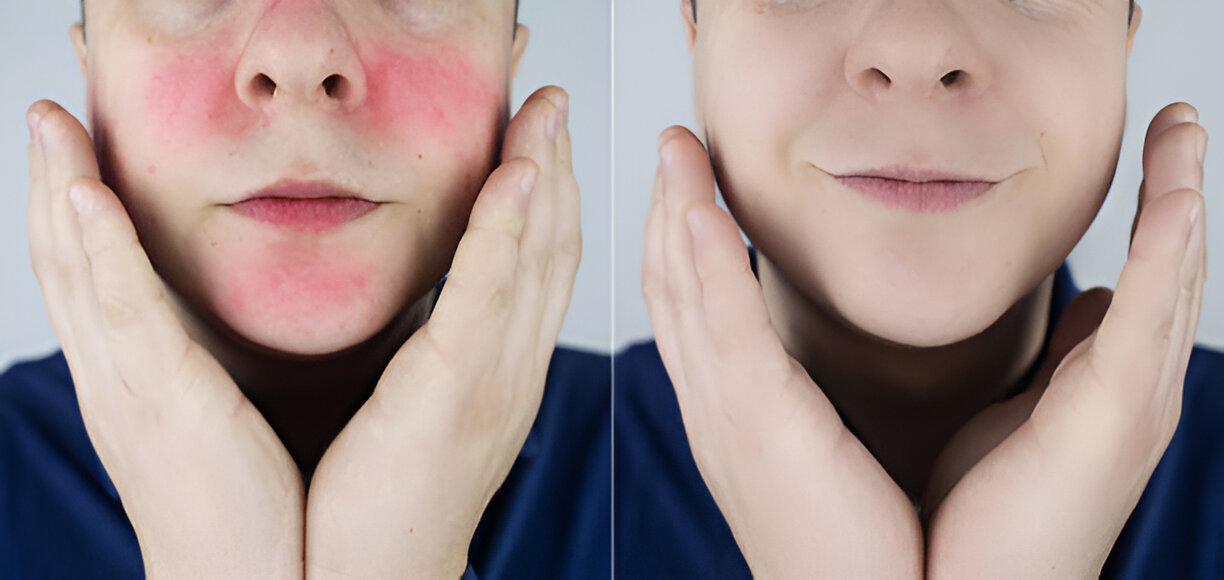 Before and after laser treatments comparison image from the practice's existing gallery