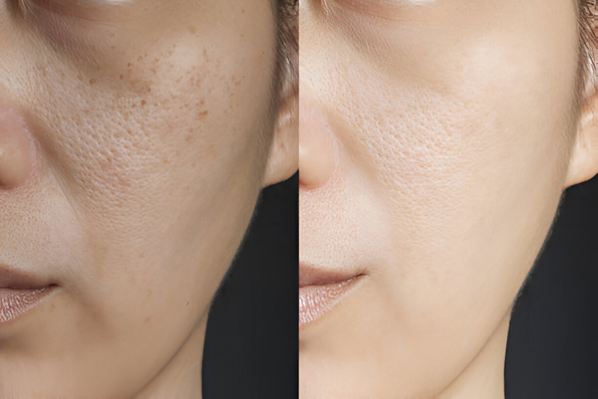 Before and after skin health comparison image from the practice's existing gallery