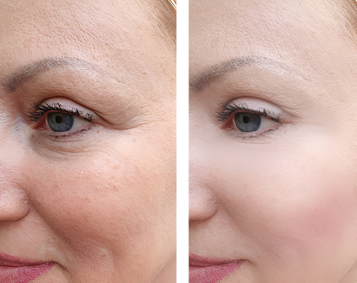 Before and after skin contouring comparison image from the practice's existing gallery